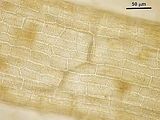 7 - Cellule corticali in visione superficiale